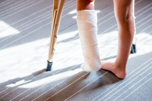 foot with injury due to fall personal injury law firm jacksonville